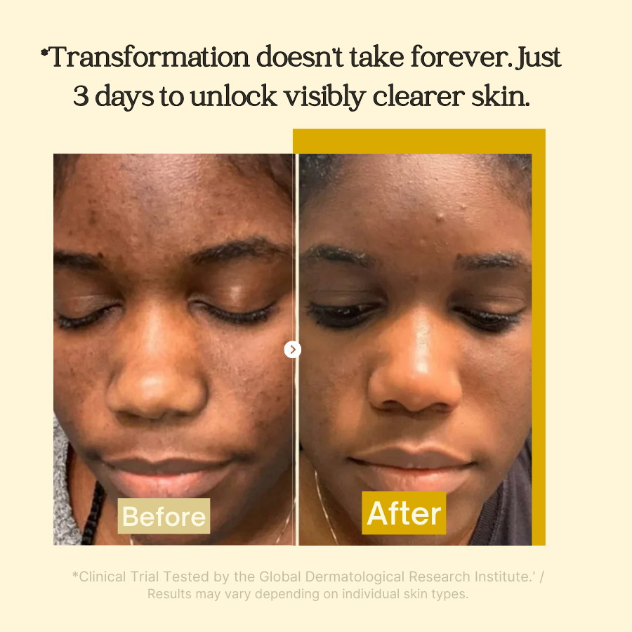 Kojic Acid Turmeric Collagen Night Mask
