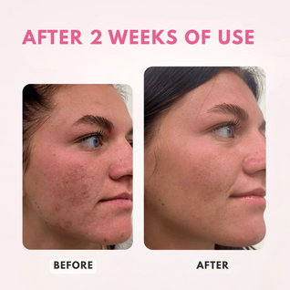 Revix Salmon DNA Caffeine + Collagen Night Mask