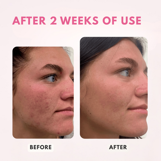 Revix Salmon DNA Caffeine + Collagen Night Mask