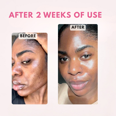 Revix Salmon DNA Caffeine + Collagen Night Mask