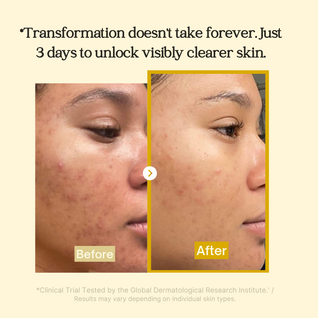 Revix Turmeric Kojic Acid + Collagen Night Mask