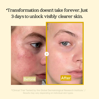 Revix Turmeric Kojic Acid + Collagen Night Mask